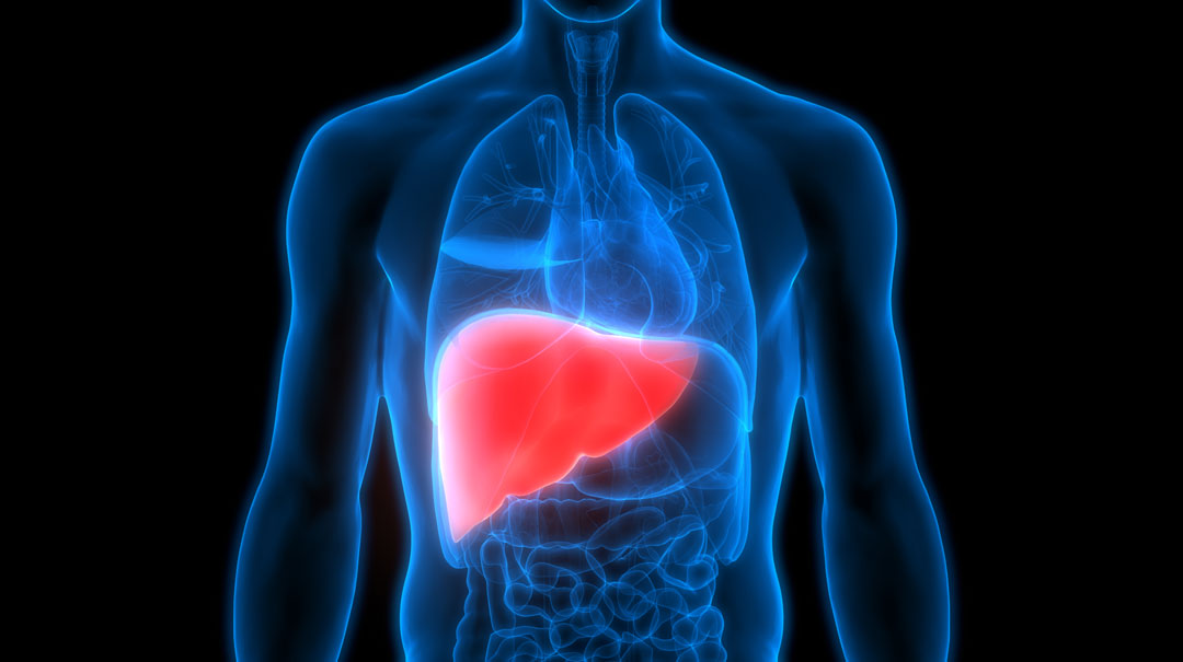 Fatty Liver Disease and Warning Signs