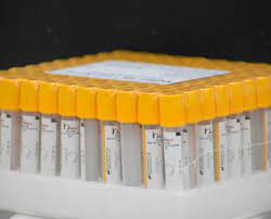 Gel Non Vacuum Tubes