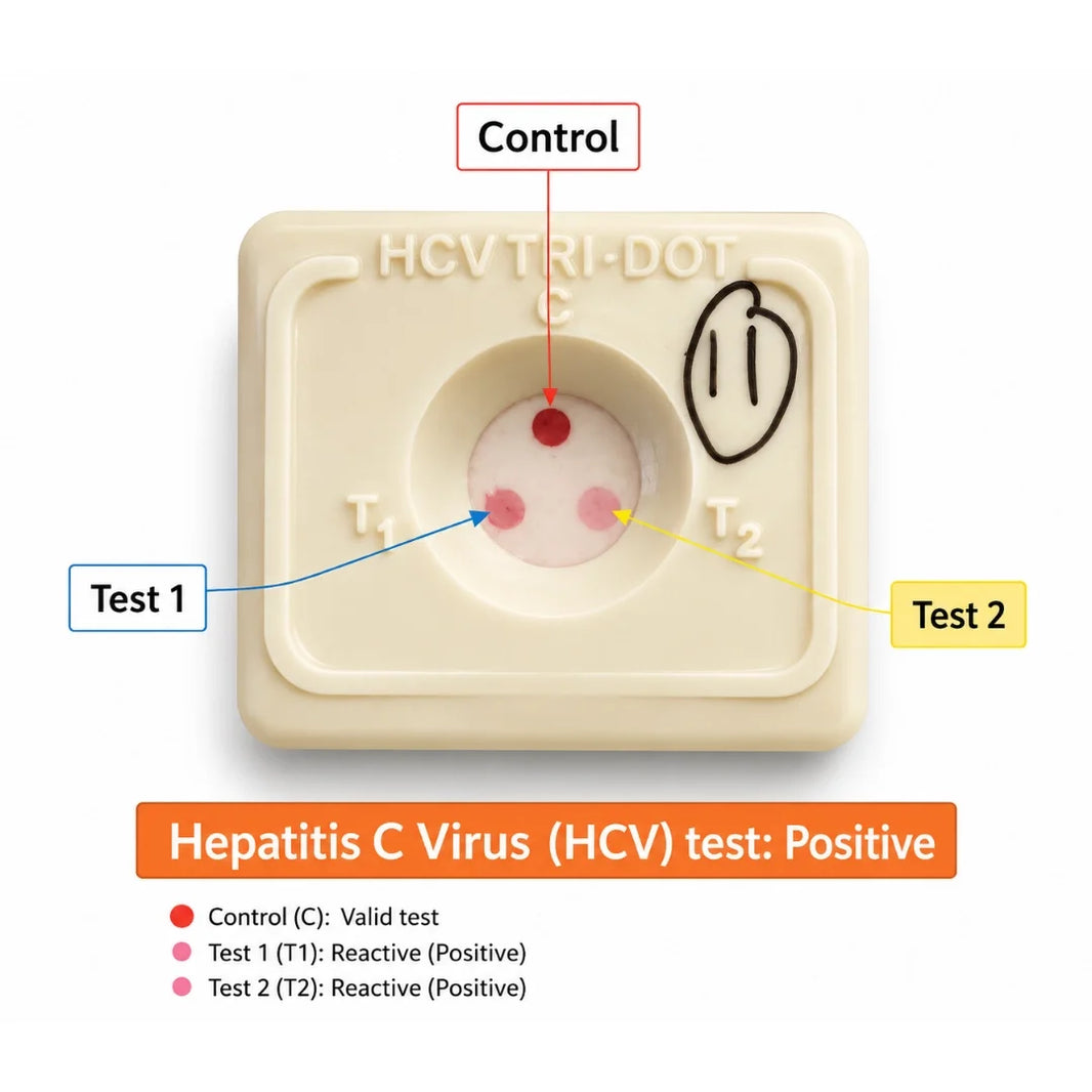 Buy J. Mitra HCV TRI-DOT 25 Test Pack for rapid HCV antibody screening in serum or plasma. 4th Generation, Flow-Through Technology, results under 3 minutes.