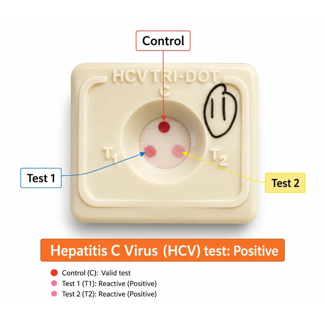 Buy J. Mitra HCV TRI-DOT 25 Test Pack for rapid HCV antibody screening in serum or plasma. 4th Generation, Flow-Through Technology, results under 3 minutes.