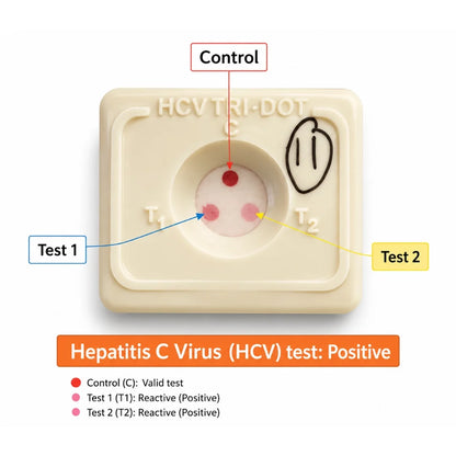 Buy J. Mitra HCV TRI-DOT 25 Test Pack for rapid HCV antibody screening in serum or plasma. 4th Generation, Flow-Through Technology, results under 3 minutes.