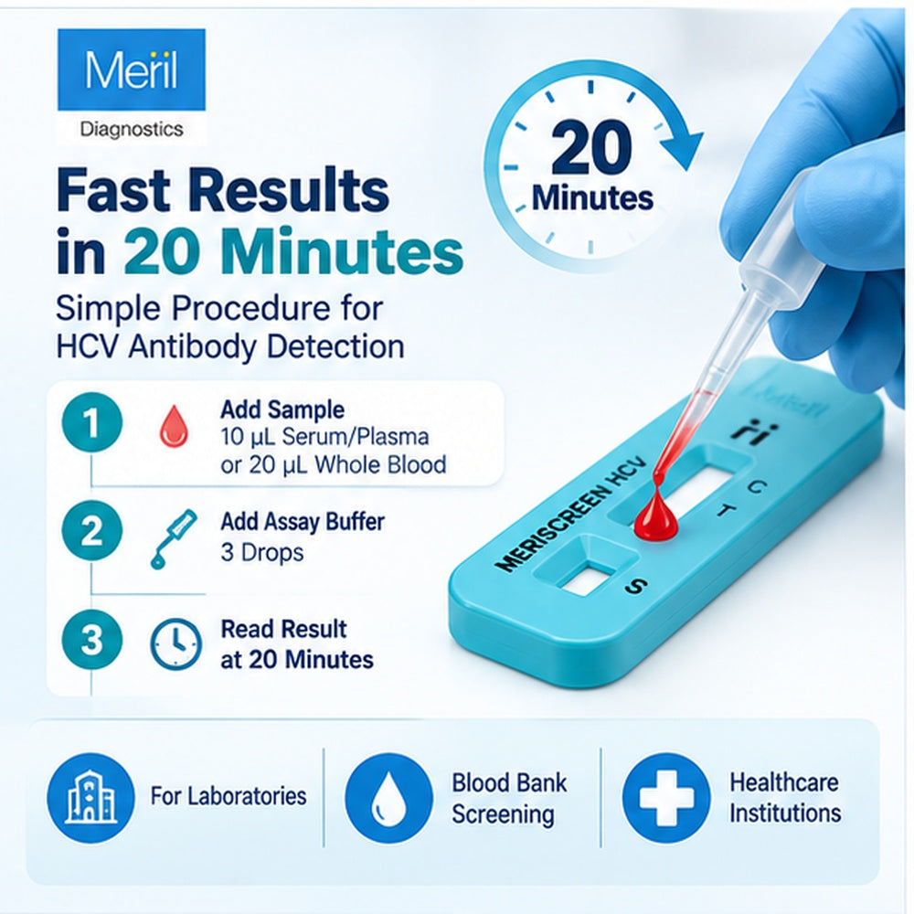 Read Result at 20 Minutes | For Laboratories | Blood Bank Screening | Professional IVD Use